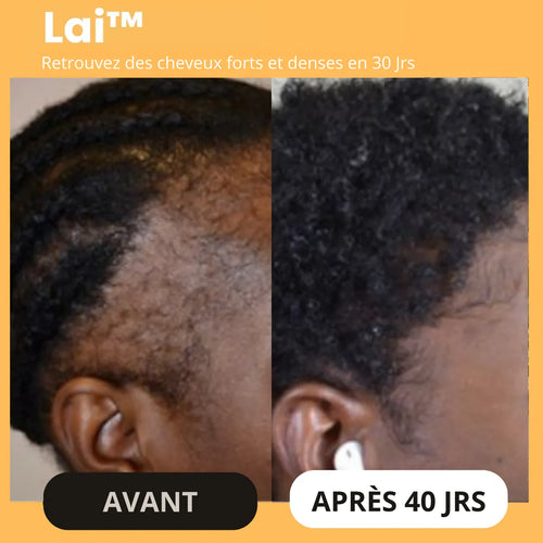 Pack Repousse Lai-Beauty