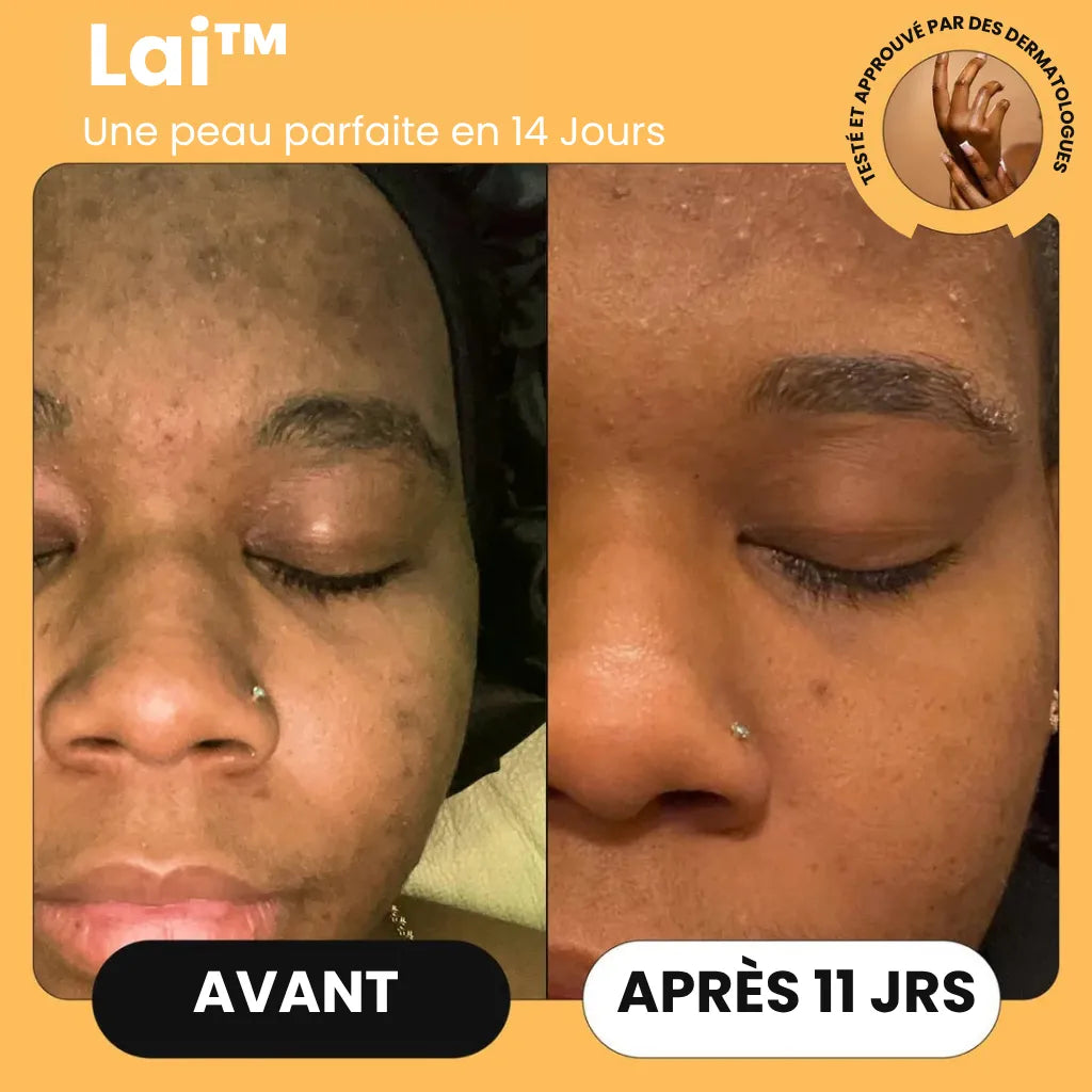 Savon Curcuma Lai™
